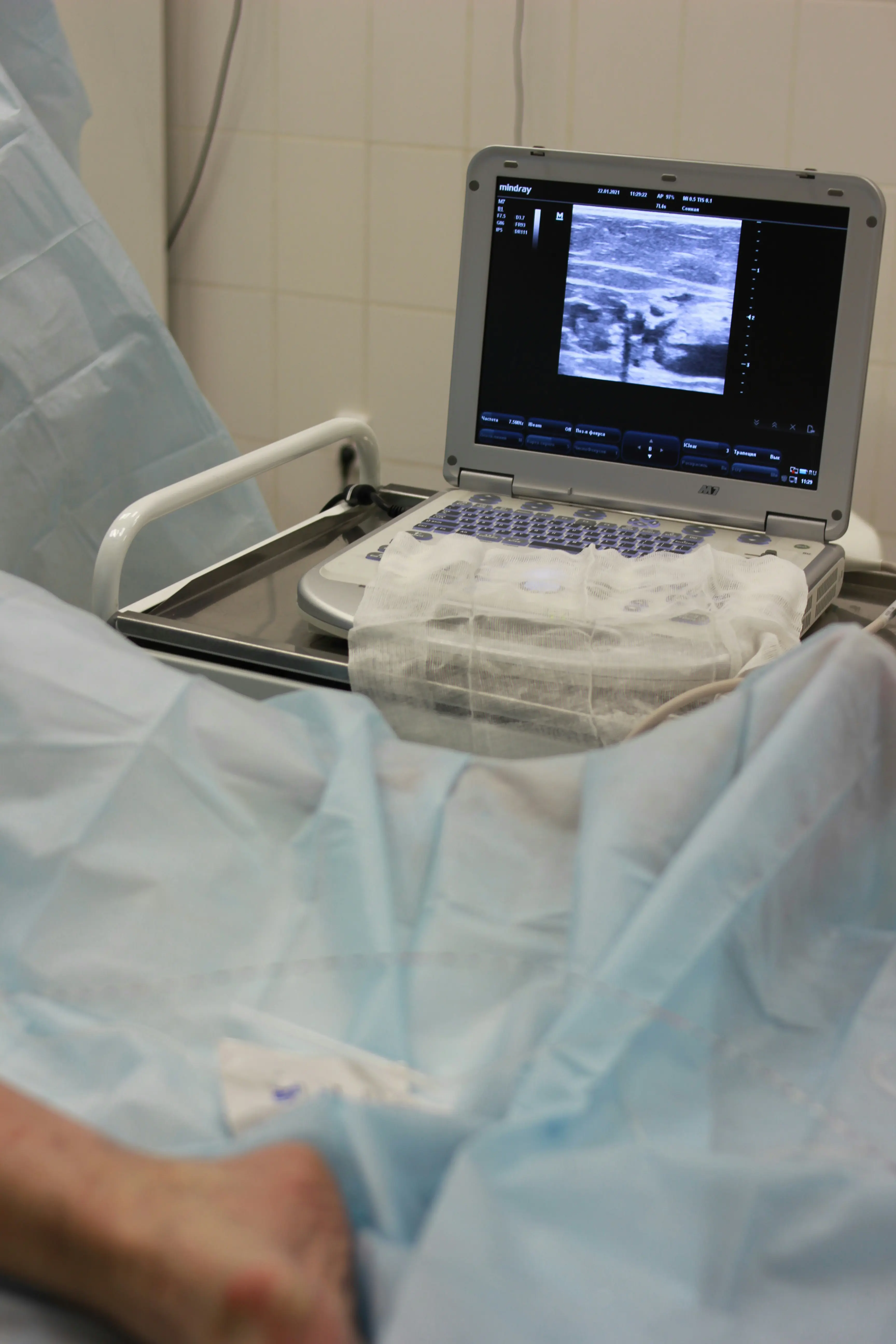 Study Reveals Gaps In Prenatal Screening Support For Down Syndrome