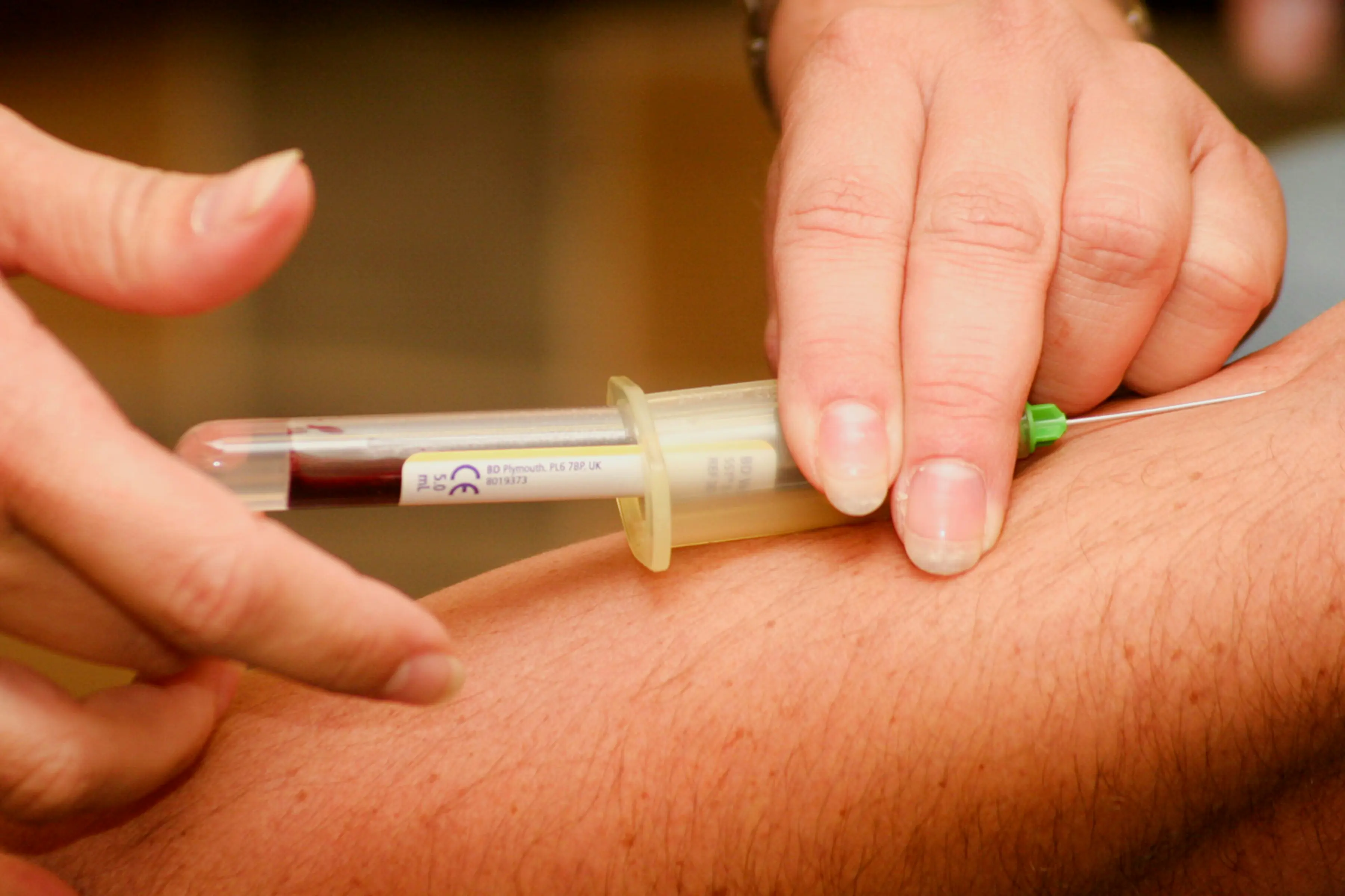 New Blood Test Offers Highly Accurate Ovarian Cancer Detection